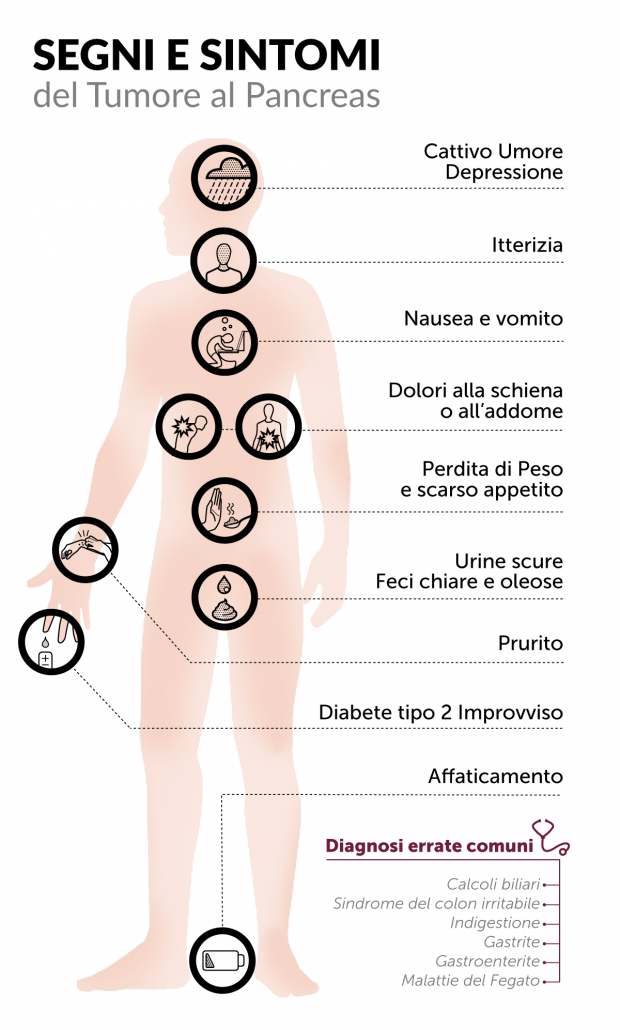 Sintomi Tumore del Pancreas - Infografica
