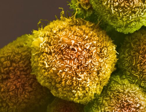 Vaccino mRNA per il tumore del pancreas